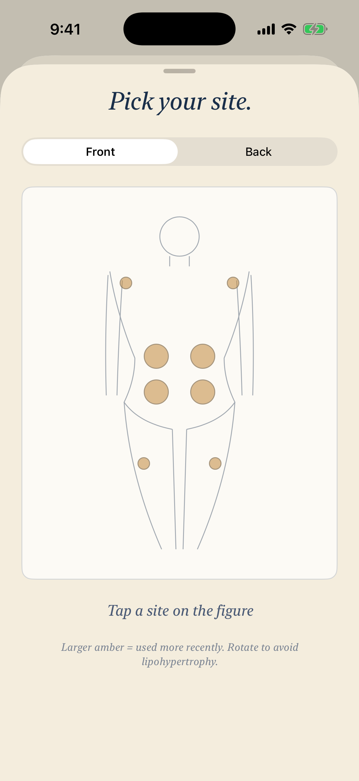 Body diagram showing 10 injection sites with amber heat-map circles indicating recent use